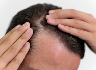 5 sposobów na naturalne zwiększenie grubości włosów