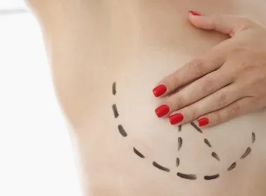 Jakie są przeciwwskazania do operacji zmniejszenia piersi?