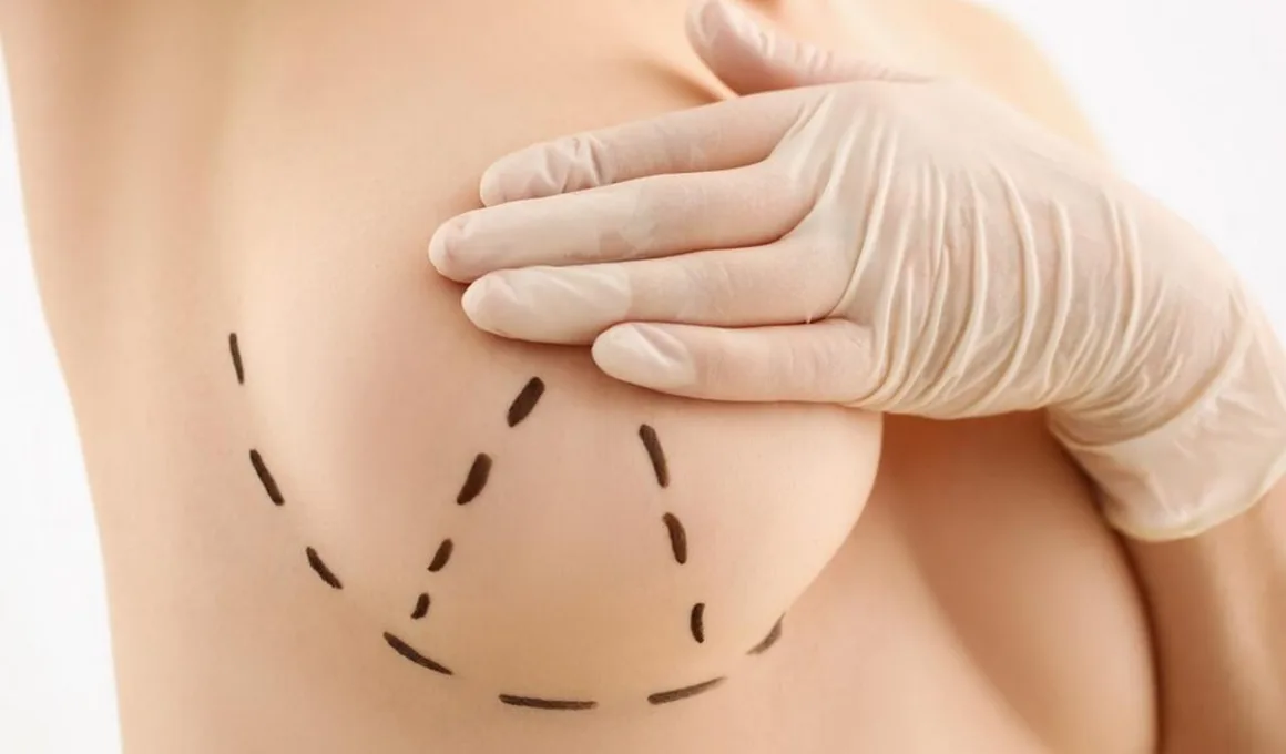 Operacja zmniejszenia piersi - czy operacja zmniejszenia piersi jest zdrowa?